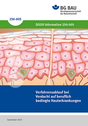 Titelbild der DGUV Information 250-005: Verfahrensablauf bei Verdacht auf beruflich bedingte Hauterkrankungen